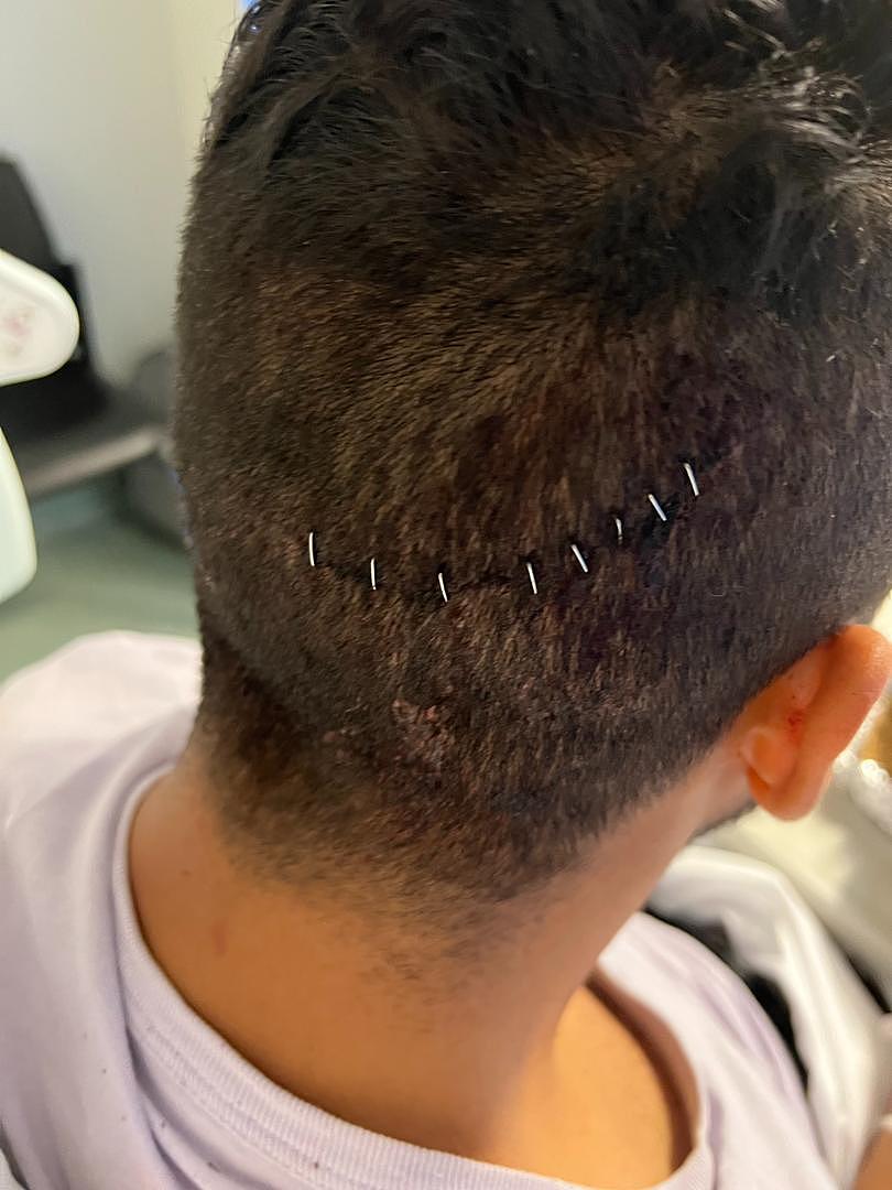 Yawinder Singh Gill needed several stitches in his head after being attacked on the job last Saturday night.