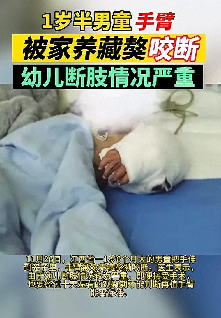 手伸狗笼遭藏獒狠咬…1岁半男婴“右臂当场扯断”，医花6小时接回（视频/组图） - 1