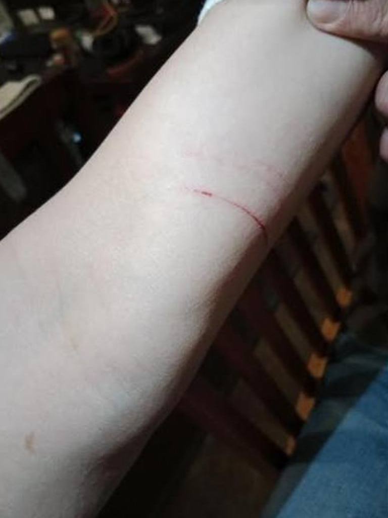 He also recieved cuts on his left forearm. Picture: Supplied