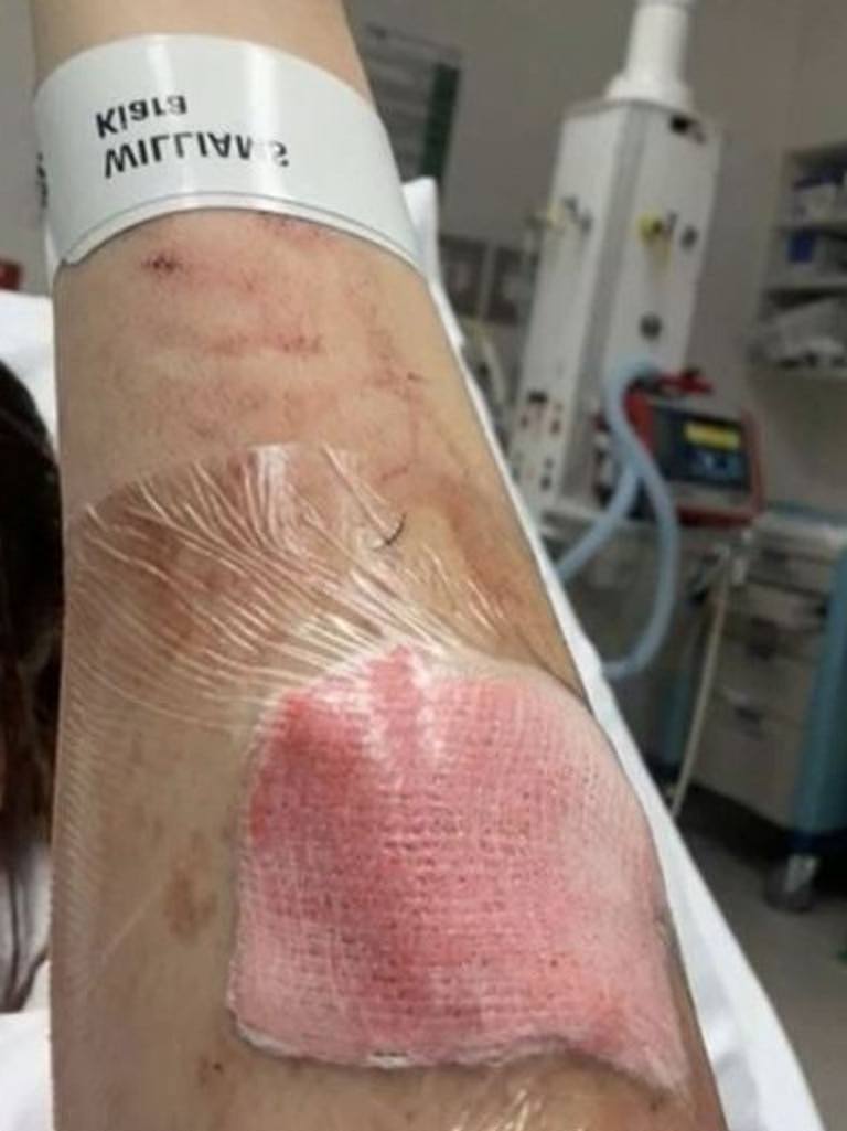 She was left bleeding at Greensborough War Memorial Park. Picture: 9News