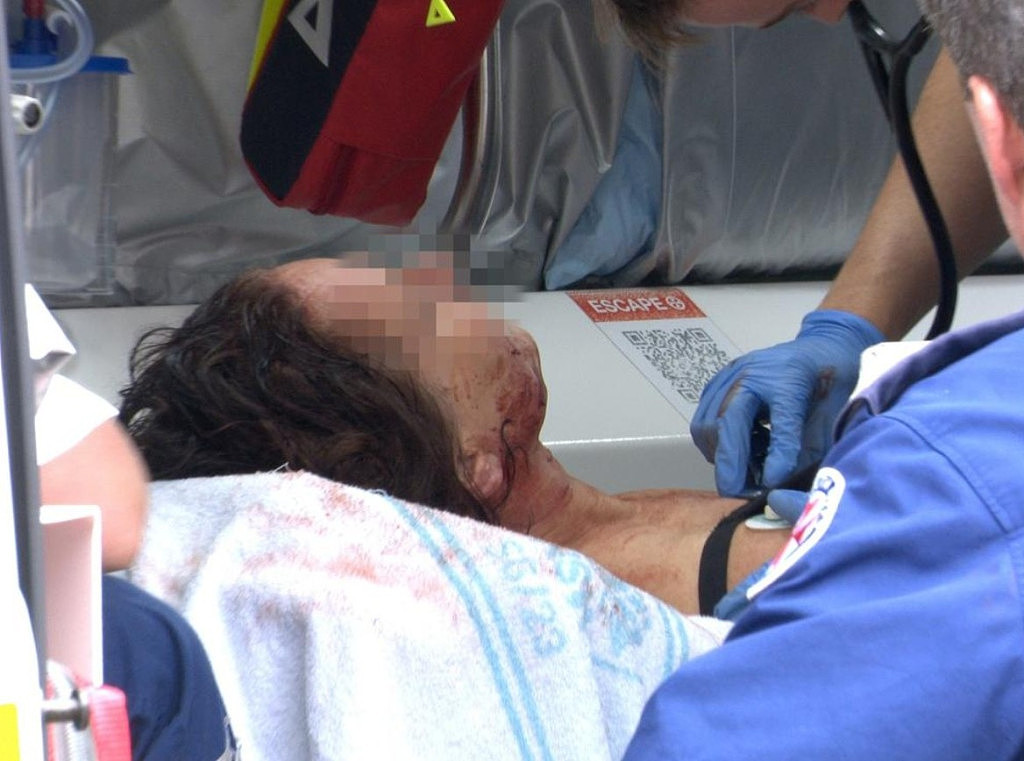悉尼东区发生持刀伤人事件！女子全身多处受伤，血洒一地（组图） - 2