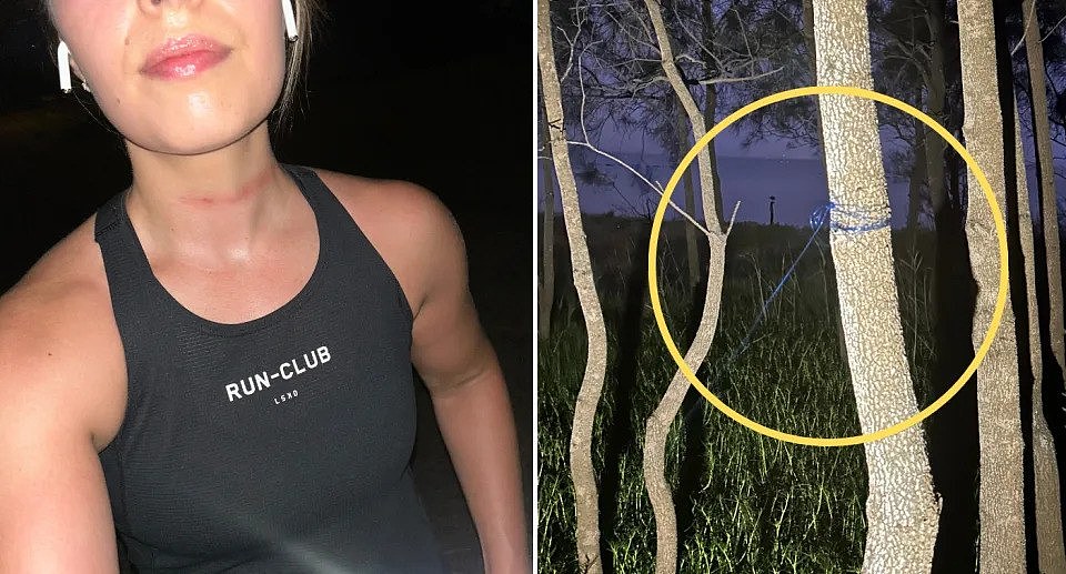 Left is an image of the injury to Leesh's neck after the incident. Right is an image of the fishing wire wrapped around a tree.