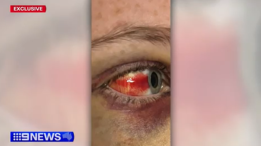澳自闭症女孩遭5名少女当街殴打！头部被重击55次，家人崩溃不已，“她差点没命”（视频/组图） - 3