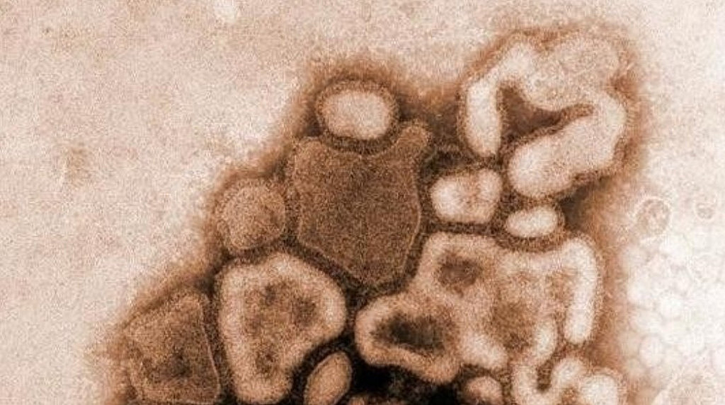 感染病例激增！澳洲今年恐迎严重流感季，当局警告：快去打疫苗（组图） - 3