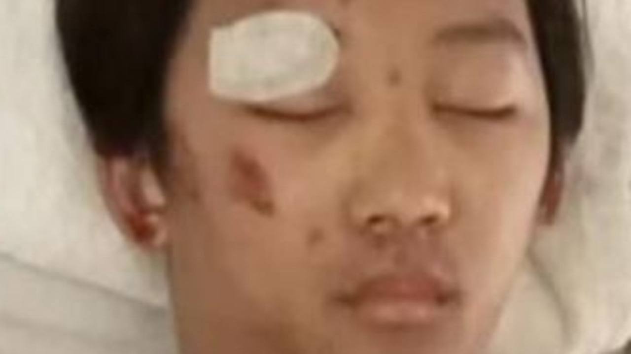 Glen Eira College student Benjamin Phikhohpoom was abducted and assaulted near his school and left in an induced coma for six days. Picture: 10 news