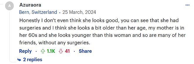 68岁女子38年做了12次整形手术，自称看起来只有43！网友：really？（组图） - 7