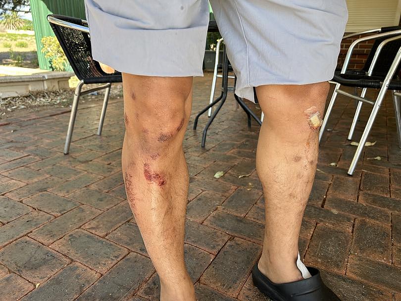 Green Street Deli 的老板 SokChhay Van 在与被指控殴打他的少年二人组发生争执后，四肢被擦伤。