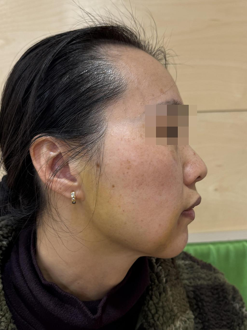 “滚回中国去”墨市华女停车场遭残暴殴打当场晕倒，72岁母亲重伤送医！哽咽回忆事发过程（组图） - 3