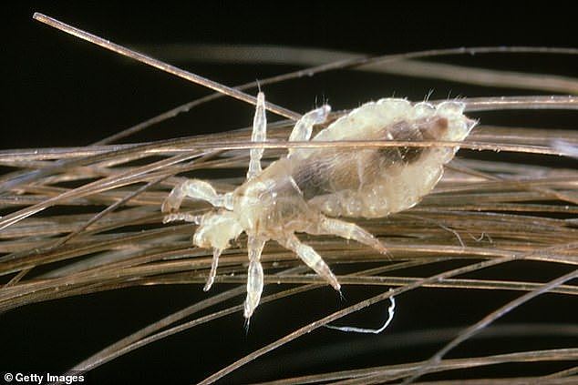 Up to 60 per cent of primary school children in Australia have head lice