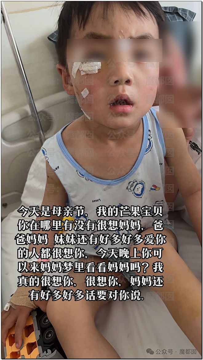 全网震怒！3岁孩子被哈士奇咬伤，打疫苗后狂犬病发作身亡（组图） - 55