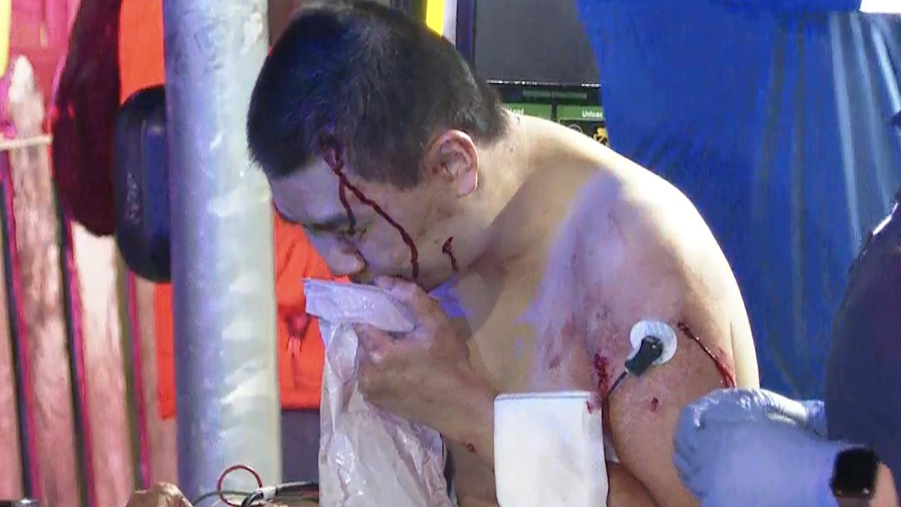一名男子和一名女子在 Marrickville 发生刺伤事件后被送往皇家阿尔弗雷德王子医院。图片来源：TNV