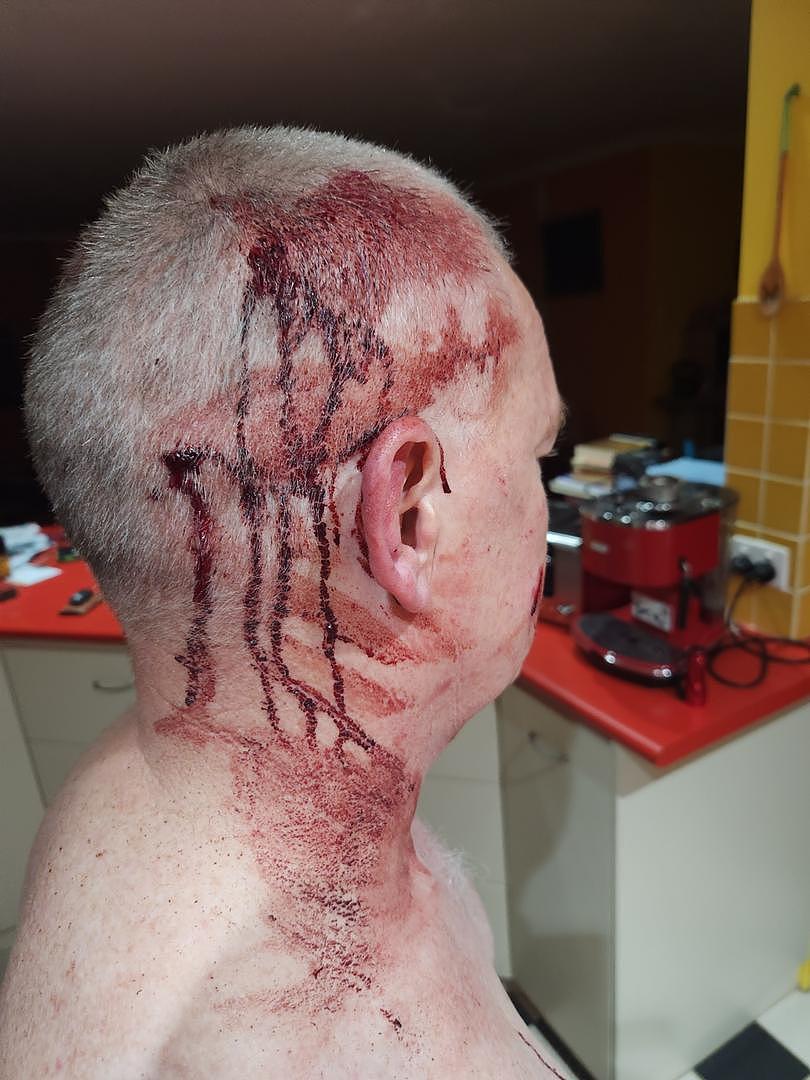 Adrian Barker after he was brutally assaulted down the road from his Bellimos Drive home on Sunday morning.