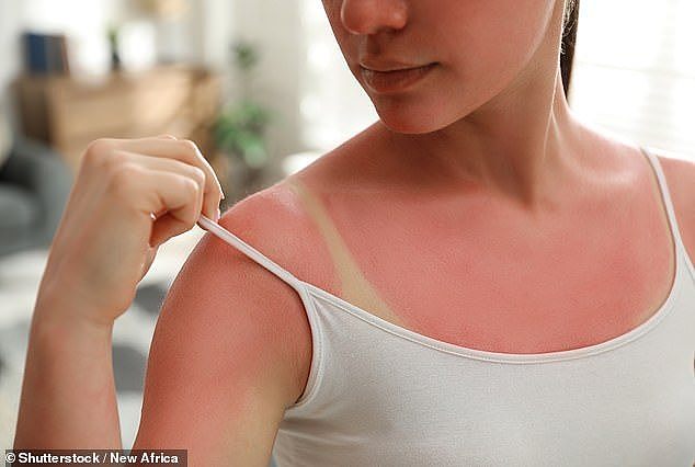 一名用户警告说：“不要晒太阳。皮肤癌不是开玩笑的，澳大利亚的阳光比世界上很多地方都要毒辣得多。”