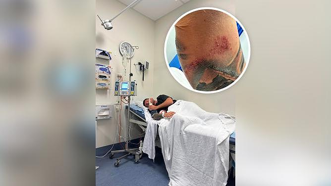 一名珀斯妇女在一次奇怪的纹身事故导致她的伴侣无法走路或说话并导致皮肤变黄后发出了严峻的健康警告。
