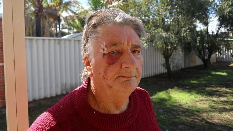 Ruth O'Brien, 78, was allegedly assaulted with a broom during a robbery in her Rangeway home.