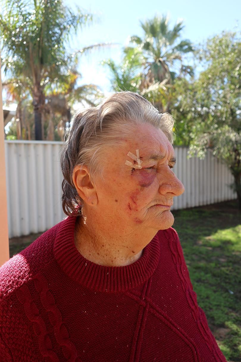 Ruth O'Brien was injured during the home invasion and robbery. 