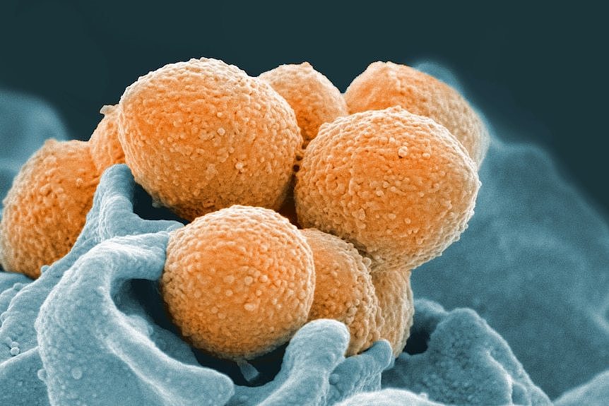 An electron microscope image of Group A Streptococcus bacteria interacting with a human neutrophil