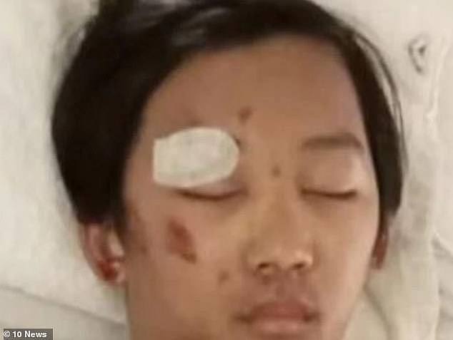Benjamin spent six days in a coma (pictured) having suffered a fractured skull and bleeding on the brain when he was allegedly dragged 150m from a stolen car driven by the group