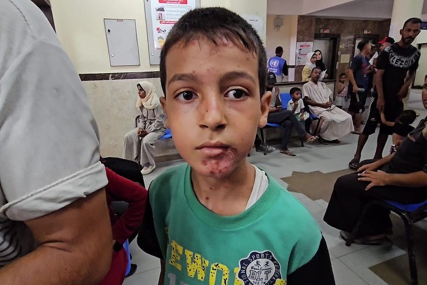 A boy with scabs on his face