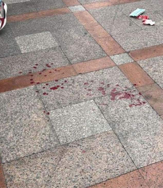 Blood was left on the pavement after the alleged bashing, and the couple supplied a photo to local police