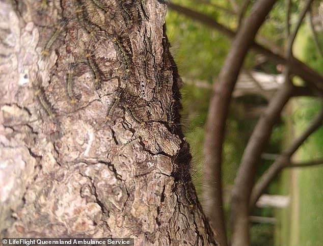 Yarren suffered a severe allergic reaction to hairy caterpillars on the tree he was climbing