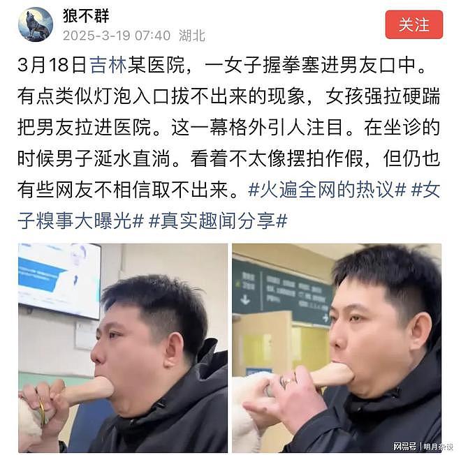 吉林一女子握拳塞进男友嘴里，却拔不出来了...（组图） - 1