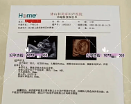 17岁彝族少女为50岁男子代孕？本科“卵妹”10万，代孕单胎20万（组图）