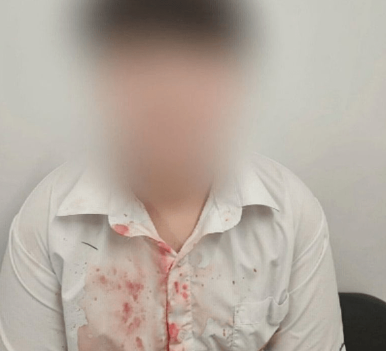 珀斯中学多次曝恐怖霸凌，14岁男孩下颚被打骨折、门牙脱落！（组图） - 3