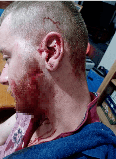 珀斯男当街遭“爆头”，伤口血流如注，警方紧急调查中！（组图） - 3