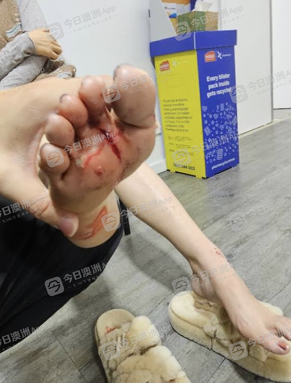 “一脚把我踹下电梯!”澳洲华人女孩当众被殴抢,市区火车站众人冷漠!“很多人,看着我倒在地上流血”(组图) - 1