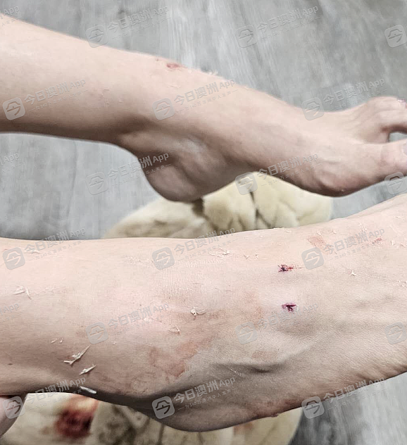 “一脚把我踹下电梯!”澳洲华人女孩当众被殴抢,市区火车站众人冷漠!“很多人,看着我倒在地上流血”(组图) - 4