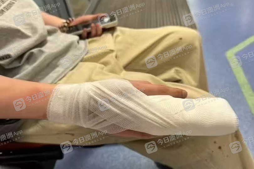 “动就杀了你！”澳洲中国留学生约会遭伏击，徒手夺刀逃过一劫！华女或为“诱饵”，蒙面双匪夺路而逃（组图） - 3