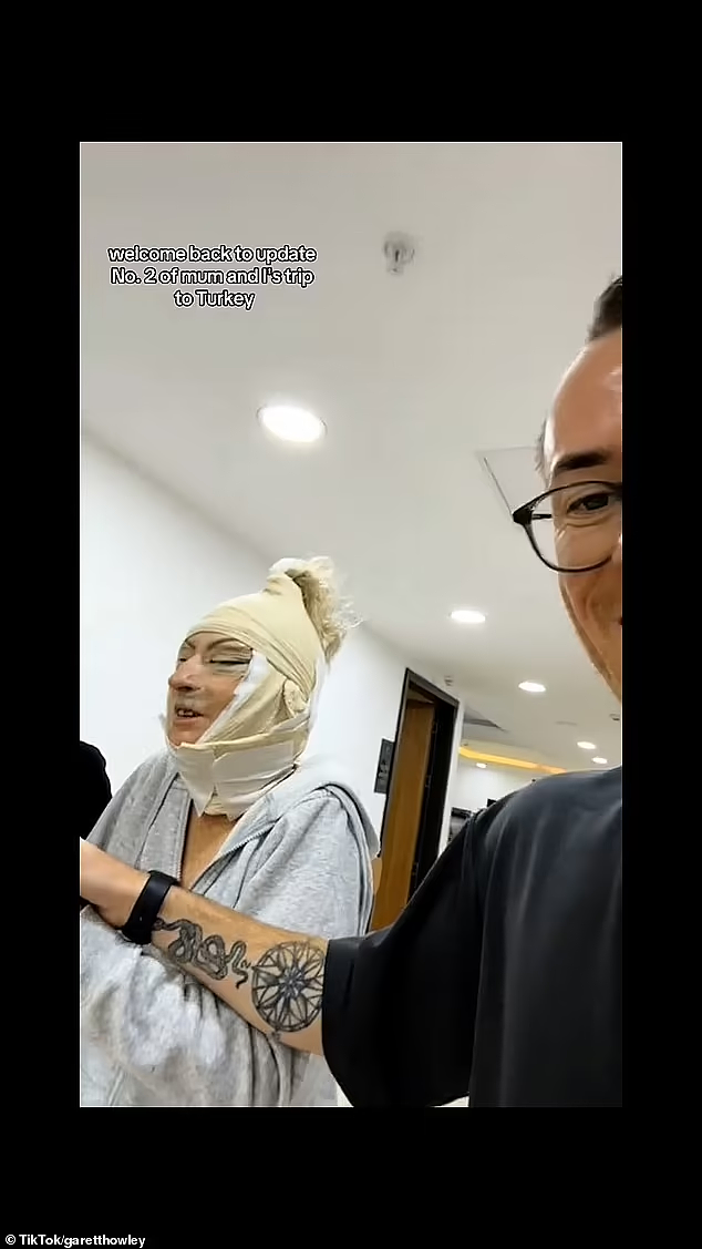 珀斯母亲远赴海外做拉皮，竟变成这副模样，网友：太吓人了（组图） - 3