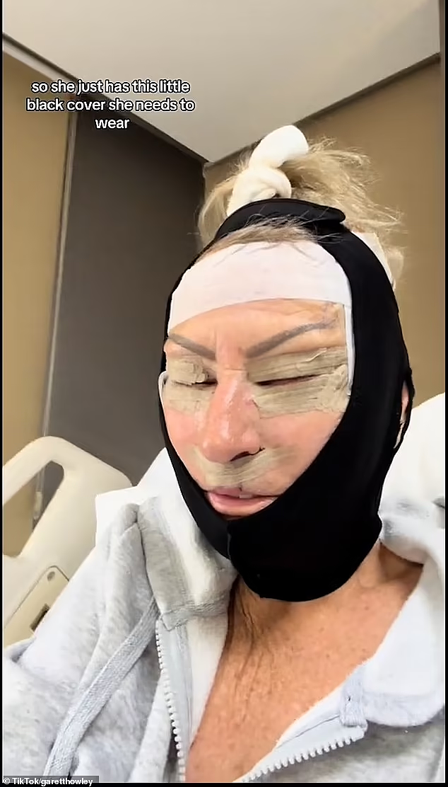 珀斯母亲远赴海外做拉皮，竟变成这副模样，网友：太吓人了（组图） - 4