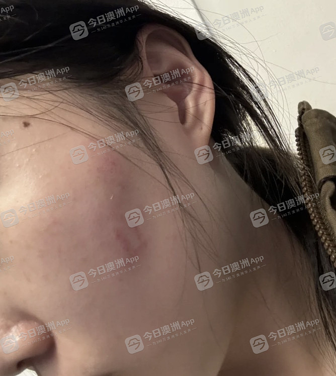 最新!悉尼华人当街遭围殴,7名青少年全部获释!华人抱团巡逻,“不是以暴制暴”(视频/组图) - 22