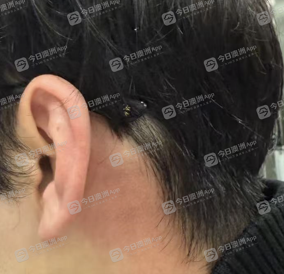 最新!悉尼华人当街遭围殴,7名青少年全部获释!华人抱团巡逻,“不是以暴制暴”(视频/组图) - 20