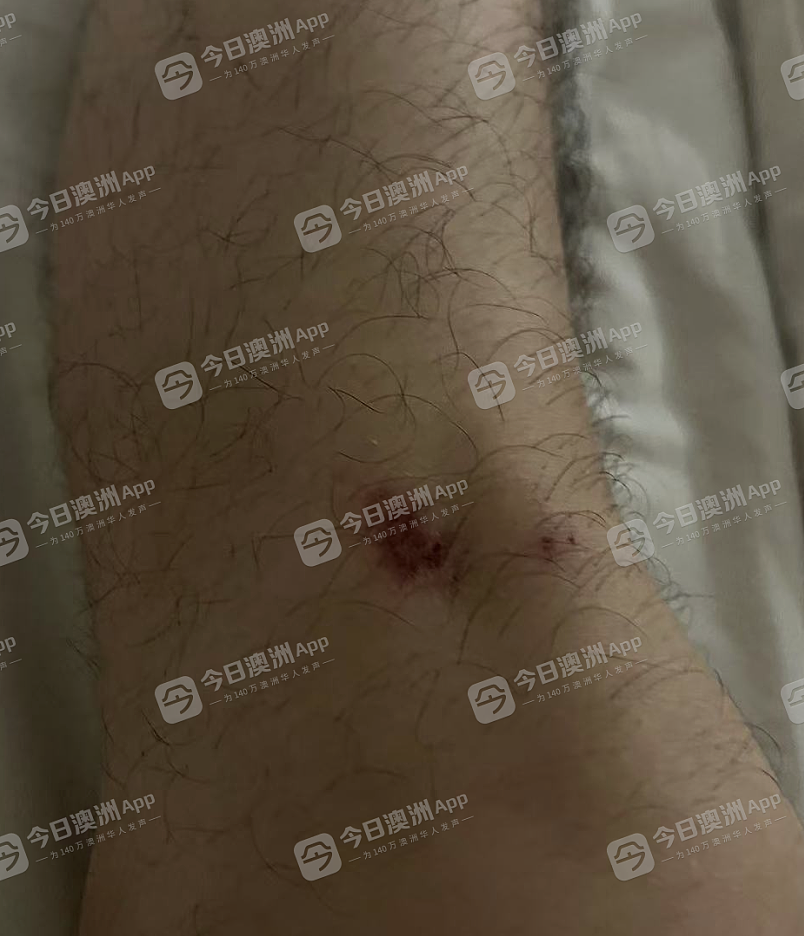最新!悉尼华人当街遭围殴,7名青少年全部获释!华人抱团巡逻,“不是以暴制暴”(视频/组图) - 21