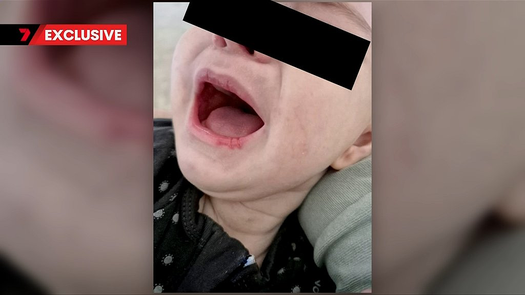 大量孩子生病,澳洲热销婴儿奶粉紧急召回!(组图) - 3