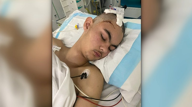 珀斯少年头部遭撞击，竟意外查出致命疾病！（组图） - 2