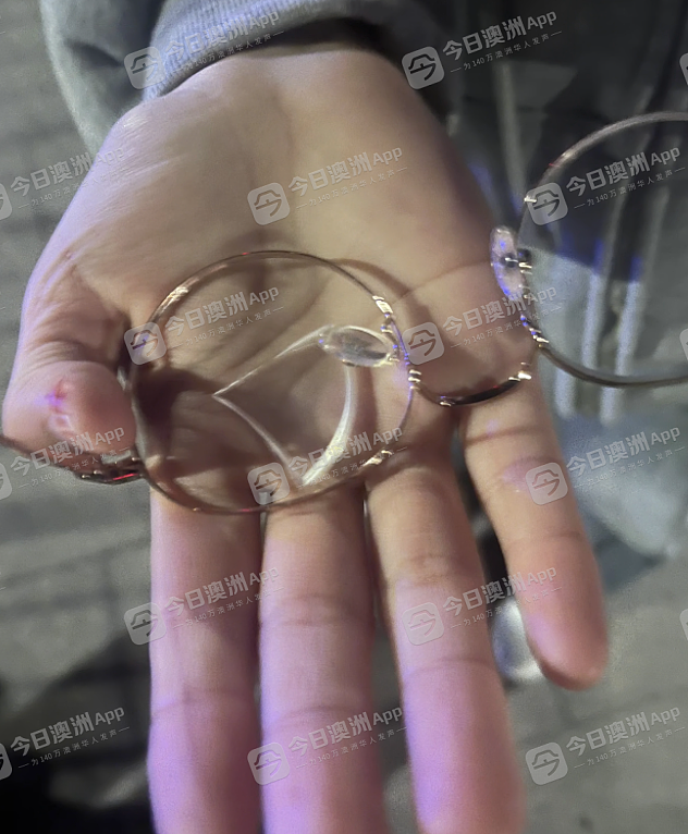“直接把我撞飞！”中国女留学生在悉尼接连遇袭，当街遭拳击面部！虽无力仍反击，“我不是孬种！”（组图） - 2