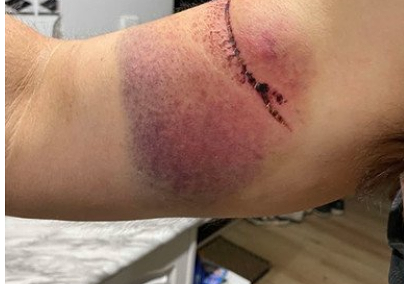 珀斯东南部热门步道成“死亡陷阱”，警方呼吁保持高度警惕（组图） - 2
