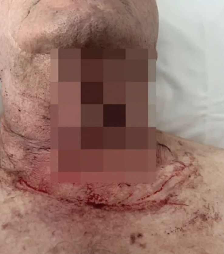 公交司机血染车站!昆州再爆恶性袭击,工会呼吁恢复安全论坛(组图) - 3