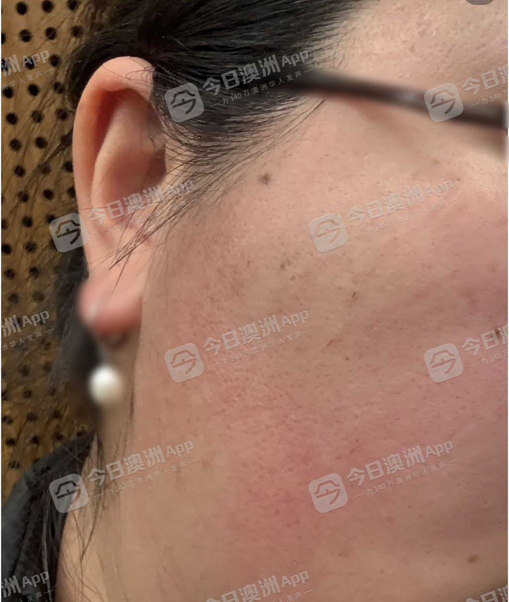 “全力一击，捶在我脸上！”华女澳洲当街遇袭，面部受伤被打肿！网友曝恶男黑史，警方被槽“只会开罚单”（组图） - 2