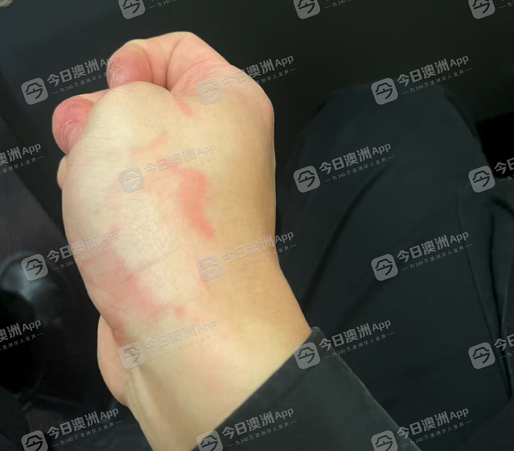 “清虫!滚出澳洲!”悉尼华人唐人街当众遇袭,遭少女围殴打伤!批警方冷漠,“小孩子的事不管”(视频/组图) - 4