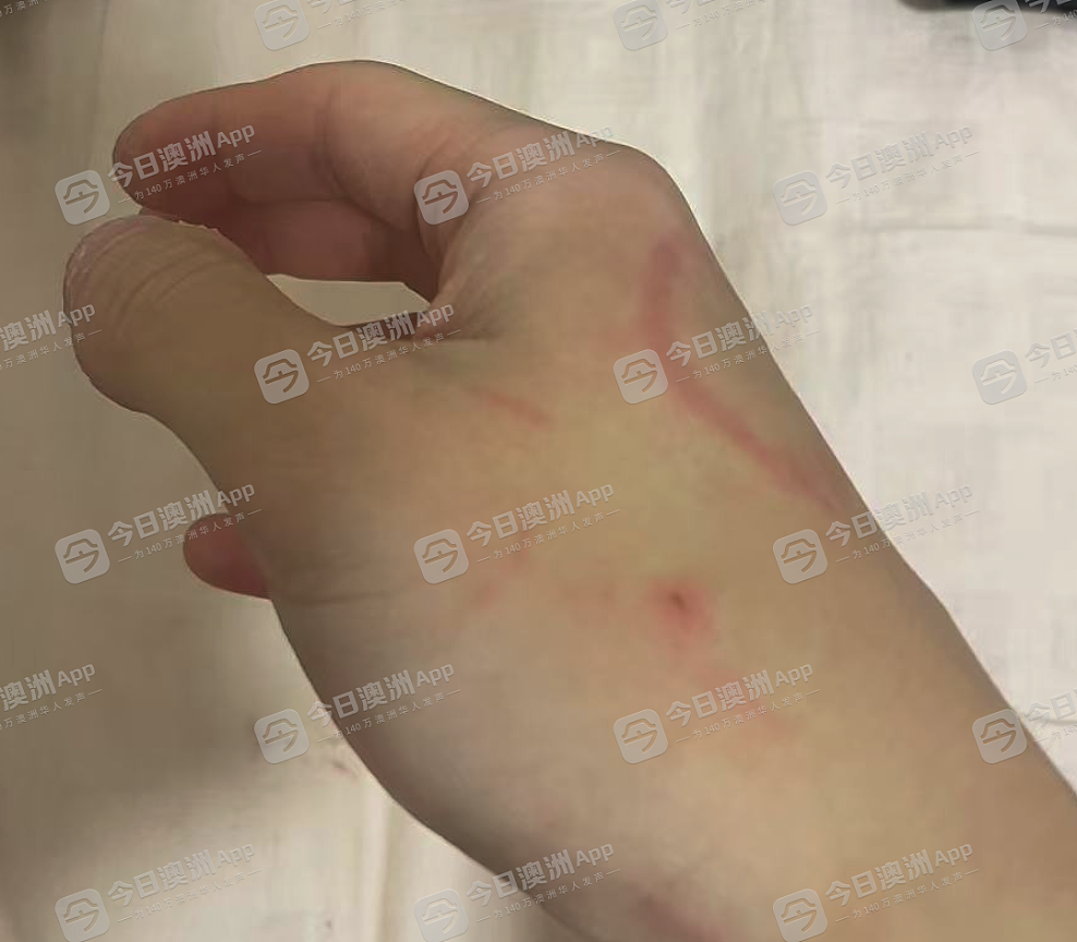 “清虫!滚出澳洲!”悉尼华人唐人街当众遇袭,遭少女围殴打伤!批警方冷漠,“小孩子的事不管”(视频/组图) - 5
