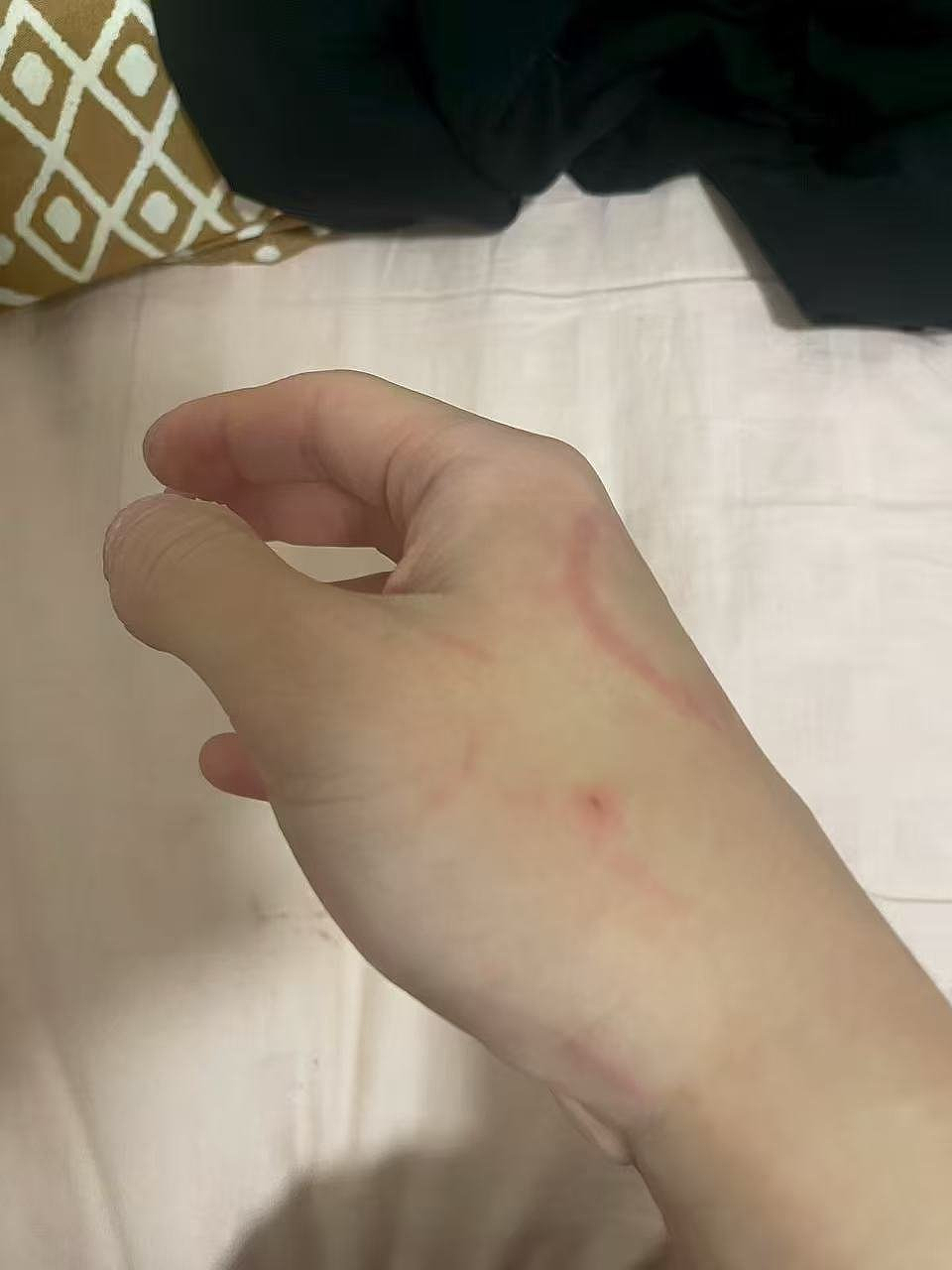 “我现在害怕出门！”澳华人Coser闹市遭一群少女袭击，更多受害者现身（视频/组图） - 3