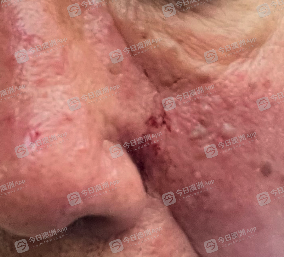 “一切痛苦都是诈骗造成！”悉尼7旬华人老翁遇“庞氏骗局”，全部积蓄打水漂还欠债！与“上线”肉搏追讨，反被控袭击（组图） - 4
