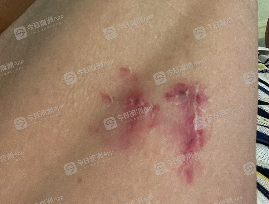 “一切痛苦都是诈骗造成！”悉尼7旬华人老翁遇“庞氏骗局”，全部积蓄打水漂还欠债！与“上线”肉搏追讨，反被控袭击（组图） - 5