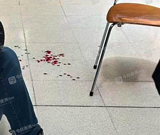 “鼻子出了好多血！”Chatswood商场内恶少高空扔购物车，老汉被砸晕血溅当场！华人店主：“治安越来越差”（视频/组图） - 4
