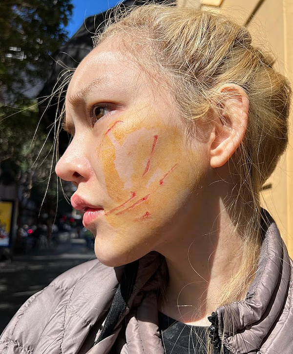 “你好了没？”疑因洗手间催门起争执，澳网红被打！华女涉伤人遭控罪（组图） - 6